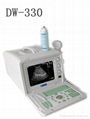 Full-Digital Portable Ultrasonic Diagnostic Apparatus DW330 1