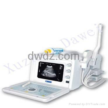 Full-Digital Portable Ultrasonic Diagnostic Apparatus DW330 3