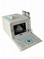 Full-Digital Portable Ultrasonic Diagnostic Apparatus DW3101A 3