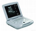 2012 New Technique Laptop Ultrasonic Diagnostic Apparatus DW500 4
