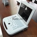 2012 New Technique Laptop Ultrasonic Diagnostic Apparatus DW500 5