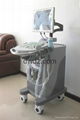 2012 Full-Digital Trolly Ultrasonic Diagnostic Apparatus DW370 5