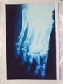dry medical imaging x ray film used in