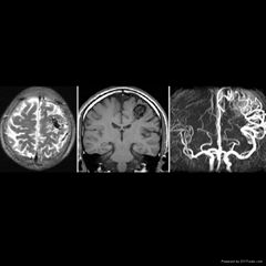 medical x ray film