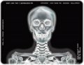 CT scan film,medical dry film,radiology film 5