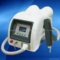 Q-Switched ND Yag Laser Tattoo Removal