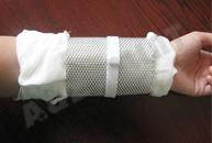 metal Wire Splint for immediate Fixer 3