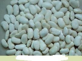 large white kidney beans 2