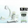 Fluoroscopy orthopedics X Ray Machine
