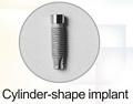 dental implant