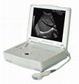 KR-1000 laptop digital ultrasound scanner   1