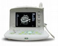 KR-1088V Portable Ultrasound Scanner