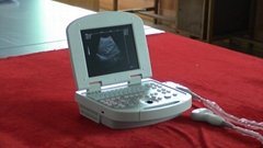 KR-1288Z Laptop Ultrasound Diagnostic Device 