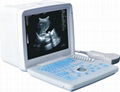 KR-2088V Full Digital Portable Ultrasound Scanner 1