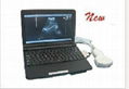 KR-2088Z LaptopKR-2088Z Laptop Full Digital Ultrasound scanner  1