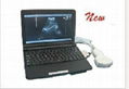 KR-2088Z LaptopKR-2088Z Laptop Full