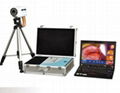 TR6000B Laptop portable Digital Electronic Colposcope