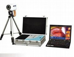 TR6000B Laptop portable Digital Electronic Colposcope