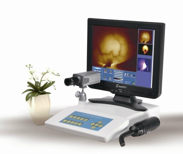 TR5000B Portable Infrared Mammary Diagnostic 1