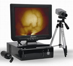 TR5000C Desktop Computer Infrared Mammary Diagnostic 