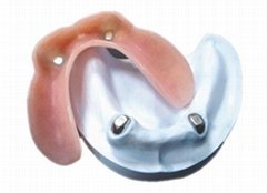 Dental Magnet Attachments