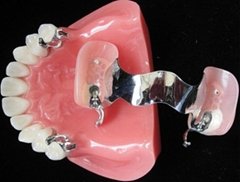 Sell Dental Implant Restorations