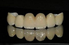 Sell Dental Cercon/Zirconium Crown and Bridge