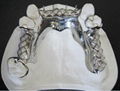 Dental Cobalt Chrome Framework