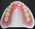 Full/Half Mouth Acrylic Denture 1