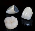 Co/Cr Non-precious Alloy PFM Dental