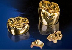 Precious Full Metal Crown Dental Denture