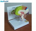normal brain model