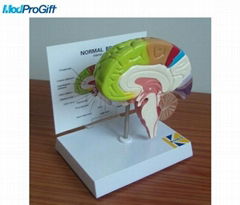 normal brain model