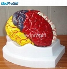 8 PRATS brain model