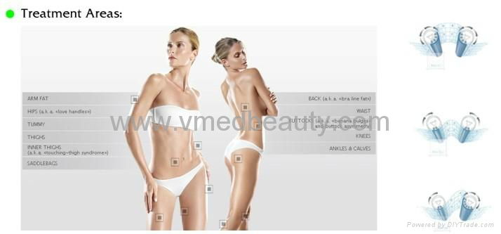 Vela Shape Weight Loss Cavitation Vaccum/Lipo Massage Slimming Equipment  5
