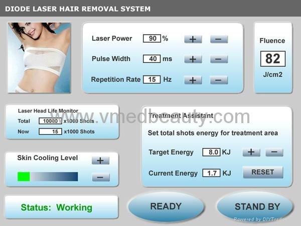 2013 Latest Hair removal 808 Diode Laser 4