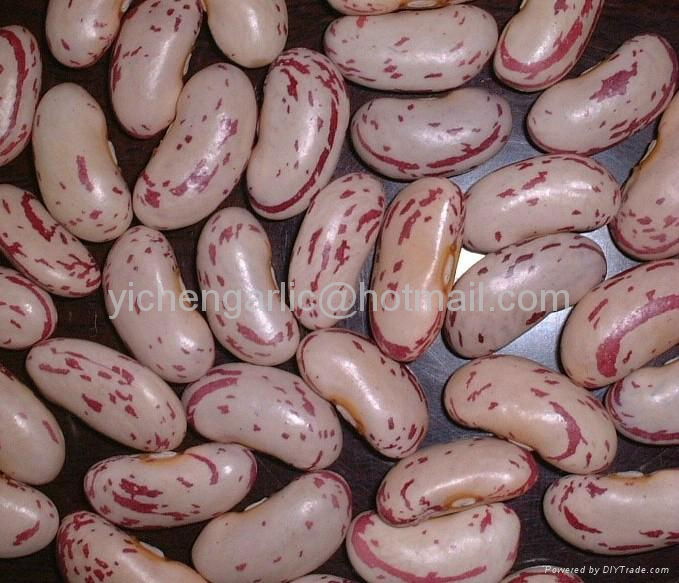 light speckled kidney beans