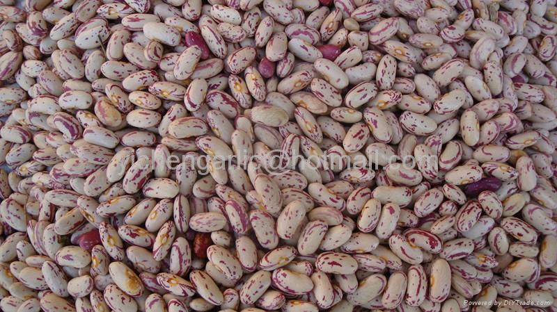 light speckled kidney beans 2