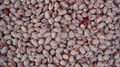 light speckled kidney beans 3