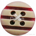 resin button  1