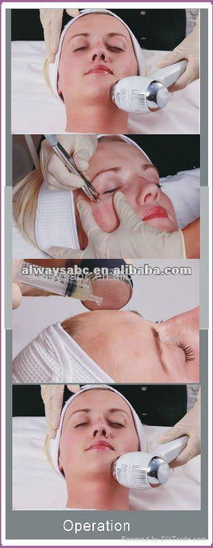 popular microdermabrasion instrument 2