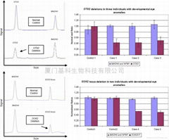 基因拷贝数变异CNVs检测