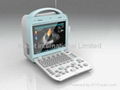 Portable Ultrasound system color doppler scanner