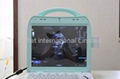 Portable Ultrasound system color doppler scanner 4