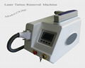 high quality tattoo removal laster machine supplies 1