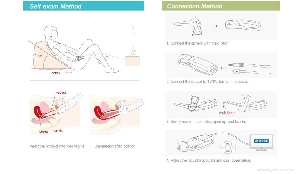 Mini Colposcope 4