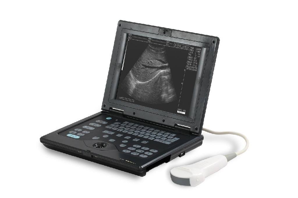 Notebook ultrasound scanner
