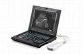 Notebook ultrasound scanner 1