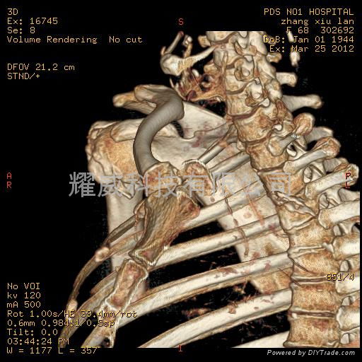 医用胶片