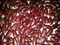 red kidney beans